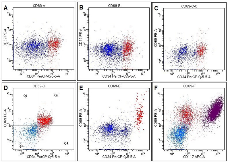 5ee099f25456d.jpg 5ee099f25456d.jpg