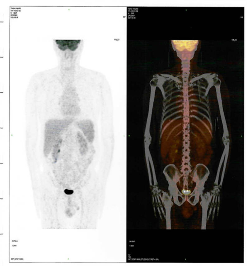 60b878dd82f8b.png 60b878dd82f8b.png