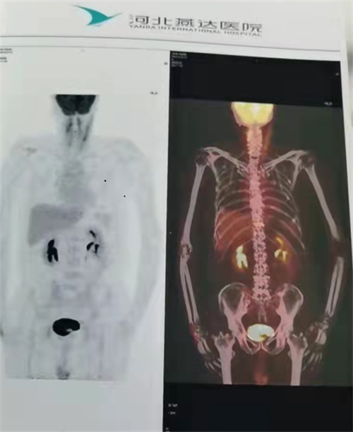 6225a7fc54de5.png 6225a7fc54de5.png