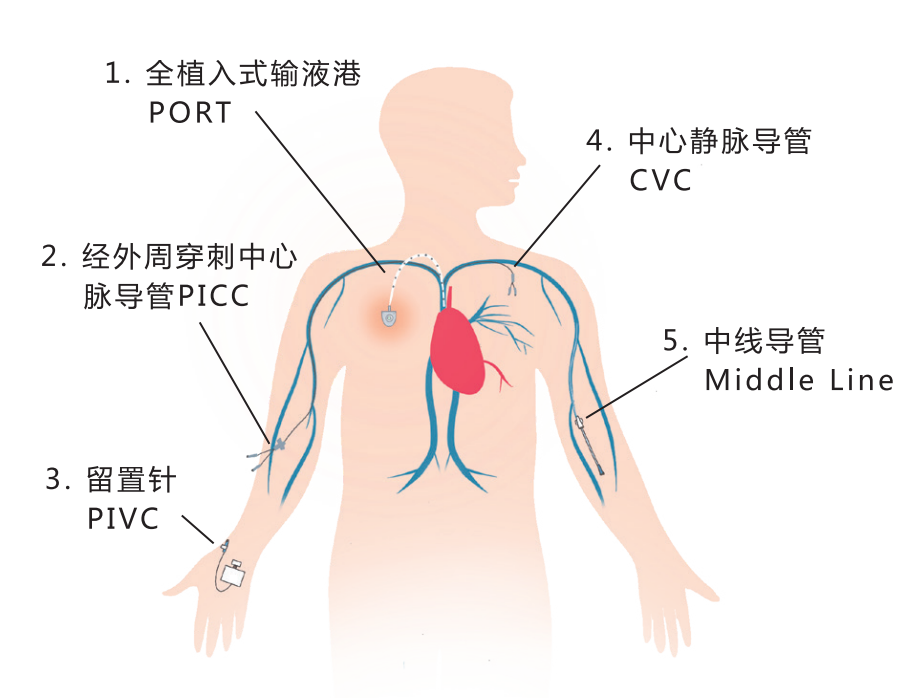 62eb307298eb3.png 62eb307298eb3.png