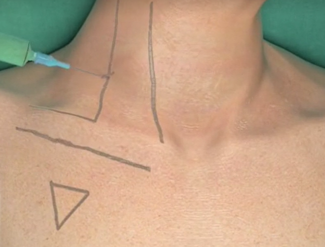 62eb3082a2e3c.png 62eb3082a2e3c.png