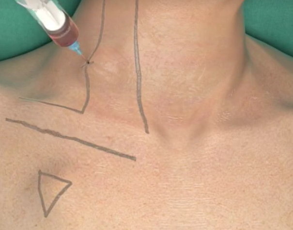 62eb308a56881.png 62eb308a56881.png