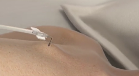 62eb30c68fd67.png 62eb30c68fd67.png