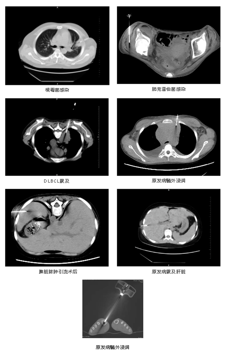 657812bb507a7.png 657812bb507a7.png