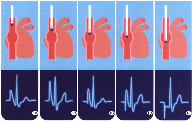 6613828e017a4.jpg 6613828e017a4.jpg